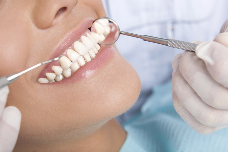 Carillas dentales: cerámica o composite. ¿Cuál se adapta mejor a mi sonrisa?