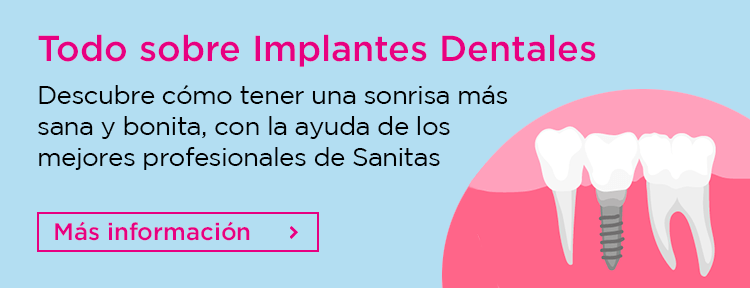 Todo sobre Implantes Dentales. Descubre cómo tener una sonrisa más sana y bonita, con ayuda de los mejores profesionales de Sanitas.