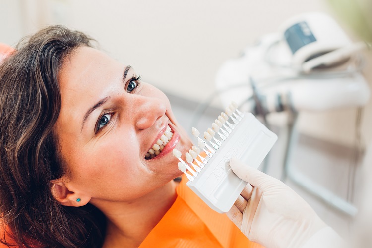 blanquear dientes en clinica dental