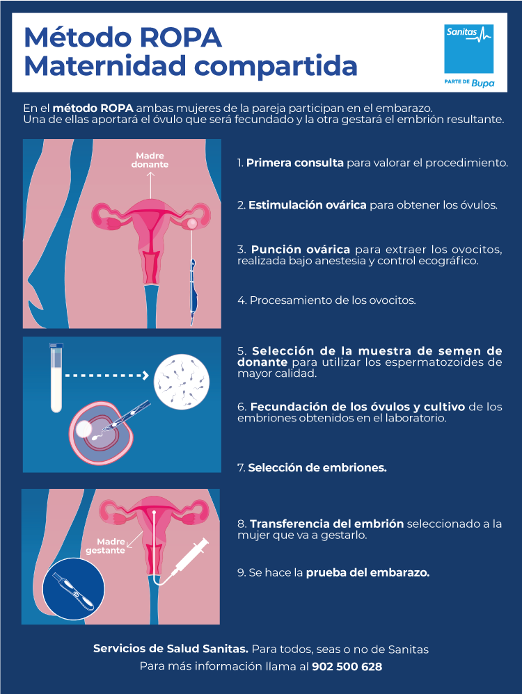 ¿Qué es el método ROPA? ¿Qué es el método ROPA?